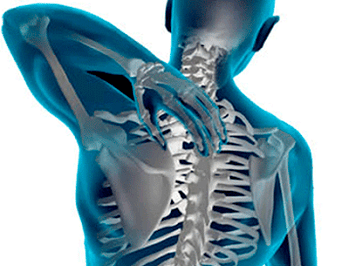 Bizkarrezurreko torakoaren osteochondrosiaren adierazpenak