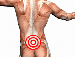 Lumbar bizkarrezurraren osteokondrosia